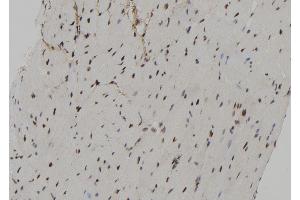 ABIN6267172 at 1/100 staining Mouse heart tissue by IHC-P. (RPS6KA3 antibody  (pSer227))