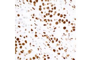 Immunohistochemistry (IHC) image for anti-Tripartite Motif Containing 28 (TRIM28) (Ser824) antibody (ABIN7454012)