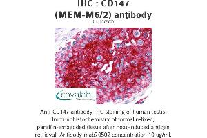 Image no. 1 for anti-Basigin (Ok Blood Group) (BSG) antibody (ABIN1723368) (CD147 antibody)