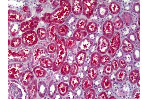Anti-ATP6V1B2 antibody IHC of human kidney, tubules. (ATP6V1B2 antibody)