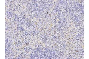 Immunohistochemistry (IHC) image for anti-TNF Receptor Superfamily, Member 6 (FAS) (AA 150-250) antibody (ABIN3020739) (FAS antibody  (AA 150-250))