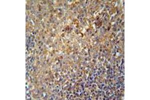 Immunohistochemical staining of formalin-fixed and paraffin-embedded human tonsil tissue reacted with SERPINA9 monoclonal antibody  at 1:50-1:100 dilution.