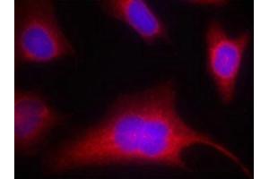 Immunofluorescence staining of methanol-fixed Hela cells using PKD/PKCm(Phospho-Ser910) Antibody. (PKC mu antibody  (pSer910))