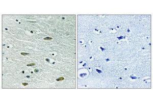 Immunohistochemistry (IHC) image for anti-Insulin-Like Growth Factor 1 Receptor (IGF1R) (Tyr1346) antibody (ABIN1848191) (IGF1R antibody  (Tyr1346))