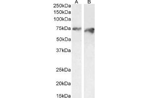 ABIN570954 (2 μg/mL) staining of HeLa (A) and (1 μg/mL) of HepG2 (B) cell lysate (35 μg protein in RIPA buffer).