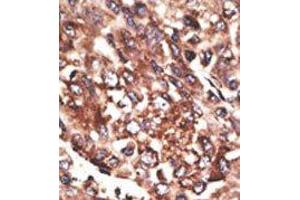 Image no. 2 for anti-Matrix Metallopeptidase 13 (Collagenase 3) (MMP13) (C-Term) antibody (ABIN358686) (MMP13 antibody  (C-Term))