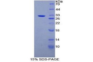 SDS-PAGE (SDS) image for Alanine Aminotransferase (ALT) (AA 290-533) protein (His tag) (ABIN2123960)