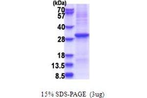 SDS-PAGE (SDS) image for Kallikrein 10 (KLK10) (AA 34-276) protein (His tag) (ABIN5853683)
