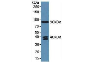 Western blot analysis of Human Serum. (C4A antibody  (AA 680-756))