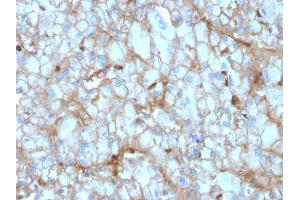 Formalin-fixed, paraffin-embedded human Kidney stained with C1QA Mouse Monoclonal Antibody (C1QA/2954). (C1QA antibody  (AA 104-237))