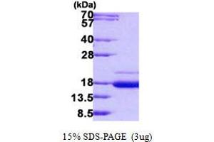 SSR2 Protein (His tag)