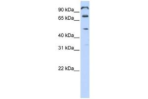 C10ORF38 antibody used at 1 ug/ml to detect target protein. (FAM171A1 antibody  (Middle Region))