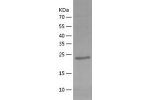 Western Blotting (WB) image for Toll-Like Receptor Adaptor Molecule 2 (TICAM2) (AA 1-235) protein (His tag) (ABIN7287817) (TICAM2 Protein (AA 1-235) (His tag))