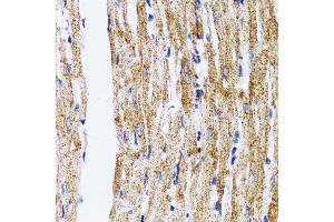 Immunohistochemistry of paraffin-embedded mouse heart using MAP1LC3B antibody. (LC3B antibody)