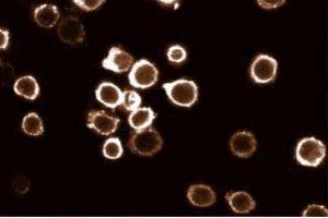 Immunofluorescent staining of HL60 cells with anti-HS1 antibody. (HCLS1 antibody  (AA 17-190))