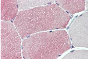 Anti-TXLNB antibody  ABIN1049448 IHC staining of human skeletal muscle. (Taxilin beta antibody  (Internal Region))