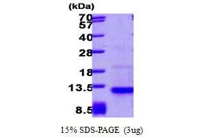 SDS-PAGE (SDS) image for Chemokine (C-C Motif) Ligand 26 (CCL26) (AA 24-94) protein (ABIN666657)