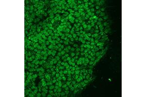 Figure 2: (OCT4 antibody)