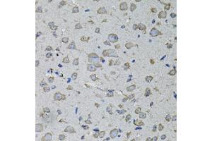 Immunohistochemistry of paraffin-embedded mouse brain using IL1A antibody (ABIN6291332) at dilution of 1:100 (40x lens).