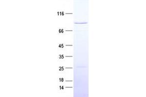Western Blotting (WB) image for Ring Finger Protein, LIM Domain Interacting (RLIM) protein (His tag) (ABIN2731016)