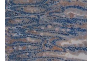 Detection of SIRT2 in Rat Intestine Tissue using Polyclonal Antibody to Sirtuin 2 (SIRT2) (SIRT2 antibody  (AA 28-303))