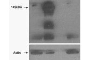 Western Blotting (WB) image for anti-Tankyrase, TRF1-Interacting Ankyrin-Related ADP-Ribose Polymerase (TNKS) (N-Term) antibody (ABIN2464160) (TNKS antibody  (N-Term))
