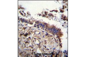 TTBK2 Antibody (N-term) (ABIN656096 and ABIN2845439) immunohistochemistry analysis in formalin fixed and paraffin embedded human lung tissue followed by peroxidase conjugation of the secondary antibody and DAB staining.