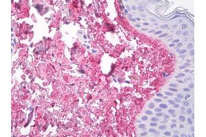 Anti-Collagen V antibody IHC of human skin, dermal collagen.