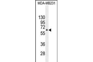 HNF1B Antibody (C-term) (ABIN655066 and ABIN2844696) western blot analysis in MDA-M cell line lysates (35 μg/lane). (HNF1B antibody  (C-Term))