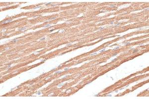 Immunohistochemistry of paraffin-embedded Rat heart using KIF4A Polyclonal Antibody at dilution of 1:100 (40x lens). (KIF4A antibody)