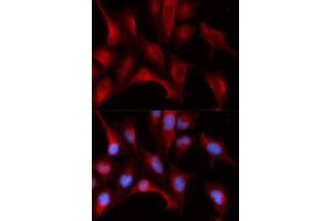 Immunofluorescence analysis of U2OS cells using PSMB4 antibody. (PSMB4 antibody  (AA 1-264))