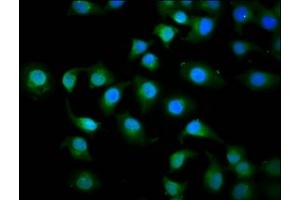 Immunofluorescence staining of A549 cells with ABIN7157651 at 1:200, counter-stained with DAPI. (KIF3C antibody  (AA 158-267))