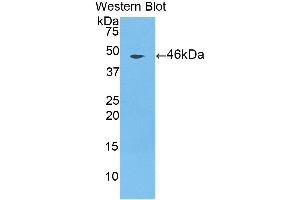 Detection of Recombinant CTSL, Porcine using Polyclonal Antibody to Cathepsin L (CTSL) (Cathepsin L antibody  (AA 115-288))