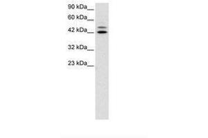 Image no. 3 for anti-Interferon Regulatory Factor 8 (IRF8) (AA 35-84) antibody (ABIN6735806) (IRF8 antibody  (AA 35-84))