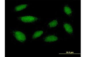 Immunofluorescence of purified MaxPab antibody to DUSP18 on HepG2 cell. (DUSP18 antibody  (AA 1-188))