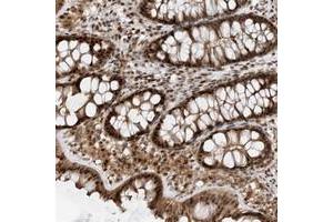 Immunohistochemical staining of human colon with TATDN3 polyclonal antibody  shows strong nuclear, cytoplasmic and membranous positivity in glandular cells. (TATDN3 antibody)