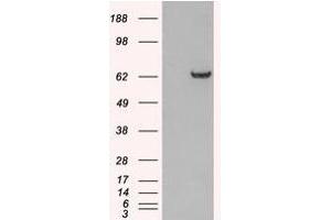 Image no. 1 for anti-Growth Factor Receptor-Bound Protein 7 (GRB7) (N-Term) antibody (ABIN374205) (GRB7 antibody  (N-Term))