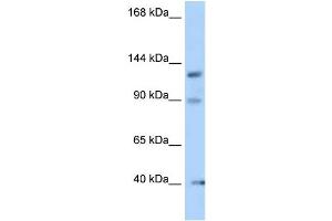 WB Suggested Anti-Ofd1 Antibody Titration: 1. (OFD1 antibody  (N-Term))