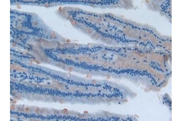 Involucrin antibody  (AA 461-551)