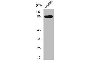 Western Blot analysis of COLO205 cells using REP-2 Polyclonal Antibody (CHML antibody  (Internal Region))