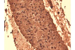 Immunohistochemistry analysis using Mouse Anti-Sodium Iodide Symporter Monoclonal Antibody, Clone 14F . (SLC5A5 antibody  (AA 468-643) (APC))