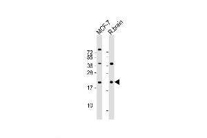 Western Blot at 1:2000 dilution Lane 1: MCF-7 whole cell lysate Lane 2: rat brain lysate Lysates/proteins at 20 ug per lane. (RAC1 antibody  (AA 49-78))