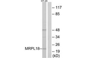 Western blot analysis of extracts from HT-29 cells, using MRPL18 Antibody.