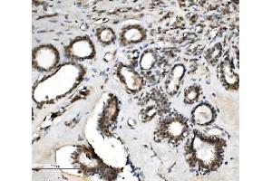 IHC analysis of VPRBP/DCAF1 using anti-VPRBP/DCAF1 antibody (ABIN7599063). (DDB1 and CUL4-Associated Factor 1 (DCAF1) (AA 1-195) antibody)