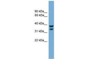 Image no. 1 for anti-Interferon Regulatory Factor 1 (IRF1) (AA 251-300) antibody (ABIN6744534) (IRF1 antibody  (AA 251-300))
