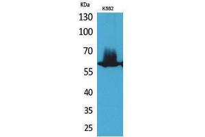 Western Blotting (WB) image for anti-Nuclear Factor-kB p65 (NFkBP65) (Thr743) antibody (ABIN3178367) (NF-kB p65 antibody  (Thr743))