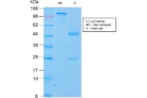 SDS-PAGE Analysis Purified SOX2 Recombinant Rabbit Monoclonal Antibody (SOX2/3169R). (Recombinant SOX2 antibody  (AA 176-305))