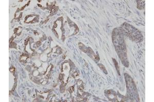 IHC-P Image Immunohistochemical analysis of paraffin-embedded H661 xenograft, using KRT2, antibody at 1:100 dilution. (Keratin 2 antibody)