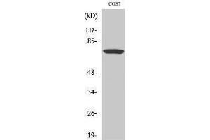Western Blotting (WB) image for anti-V-Raf-1 Murine Leukemia Viral Oncogene Homolog 1 (RAF1) (pSer259) antibody (ABIN3182138)