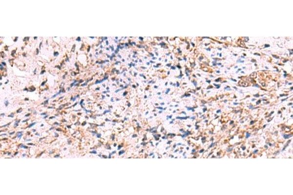 OSBPL2 antibody